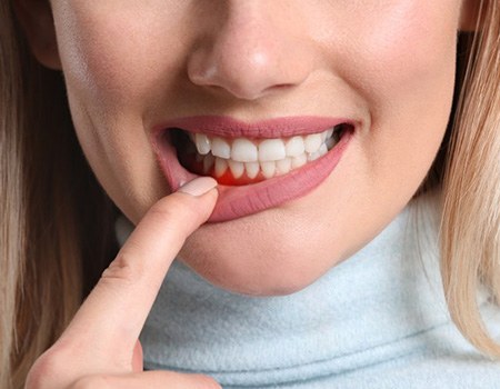 a woman showing red and swollen gums