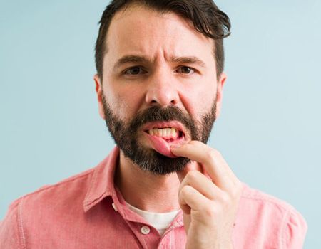 a man showing signs of gum disease