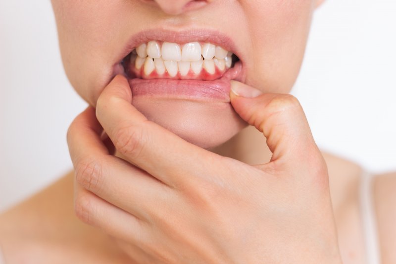 A young woman revealing her sore and inflamed gums